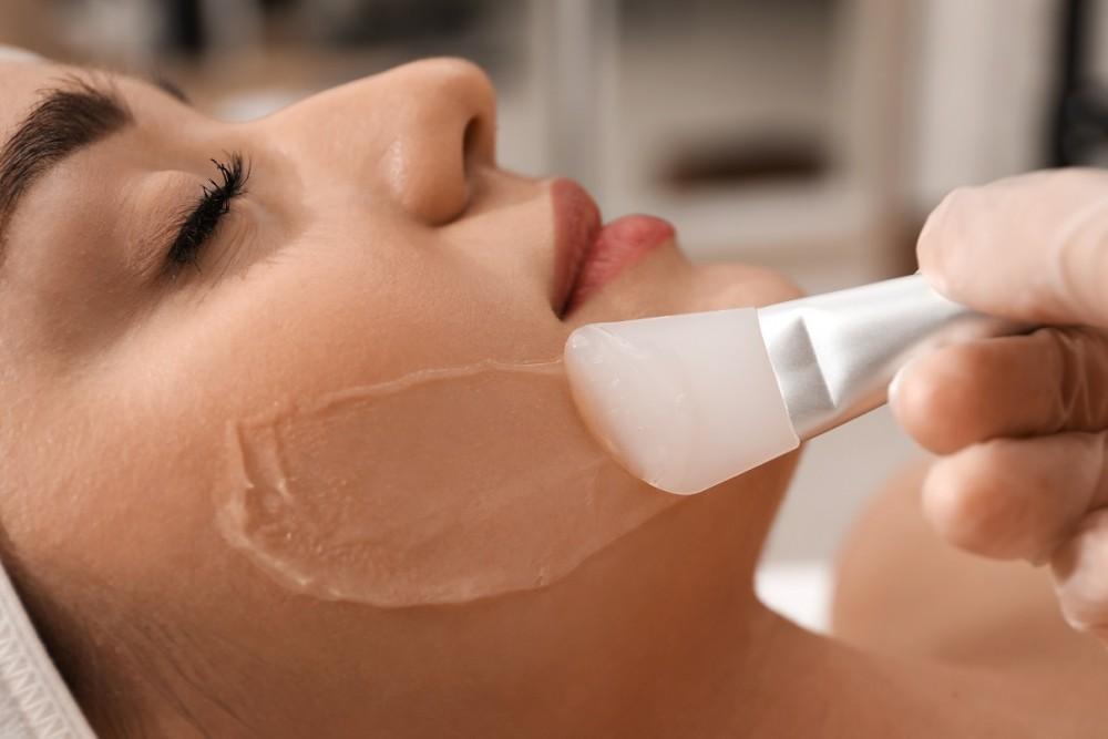 Chemical peels